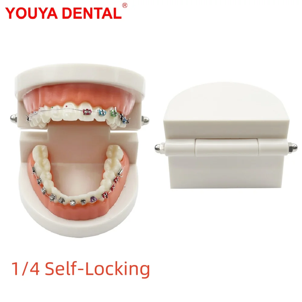 

1/4 Self-Locking Orthodontic Model With Brackets Ceramic Metal Ortho Dental Models For Patient Education Studying Teaching Demo