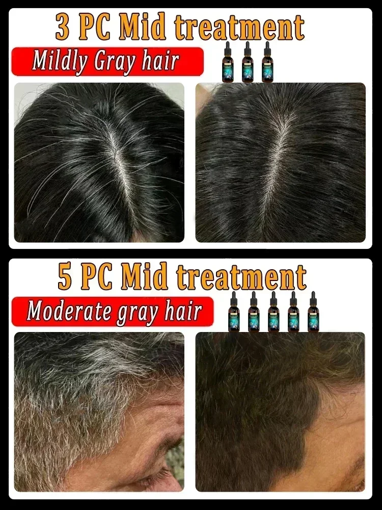 Nourrir les cheveux anti-perte pour hommes et femmes, soin capillaire, naturel, gris, blanc, traitement, sérum, liquide, blanc à noir, réparation de documents naturels