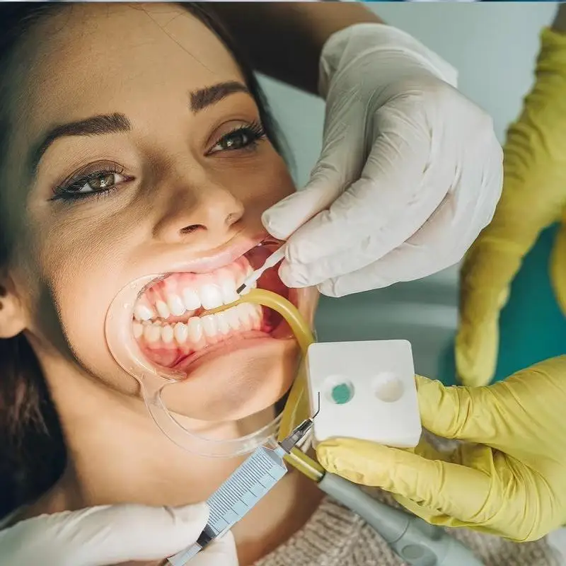 100 Stück gebogene elektronische Dosiernadeln, gebogene Dental-Dosierspitzen, Einweg-Composite-Applikator – Detail 3