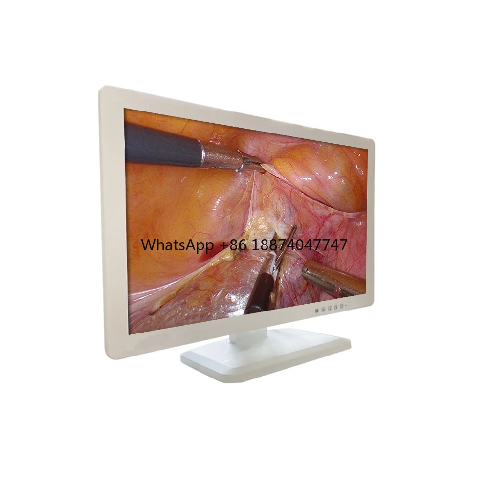 

Монитор для эндоскопии-для лапароскопии высокого качества, недорогой медицинский, диагональ 27 дюймов