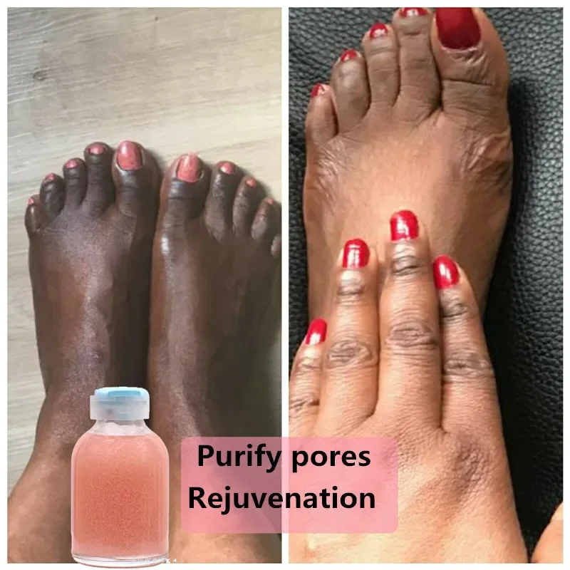 

30ml Strong Hand and Feet Lightening Whitening Cleansing Serum To Clean Up Dark Knuckles Melting and Brightening Skin