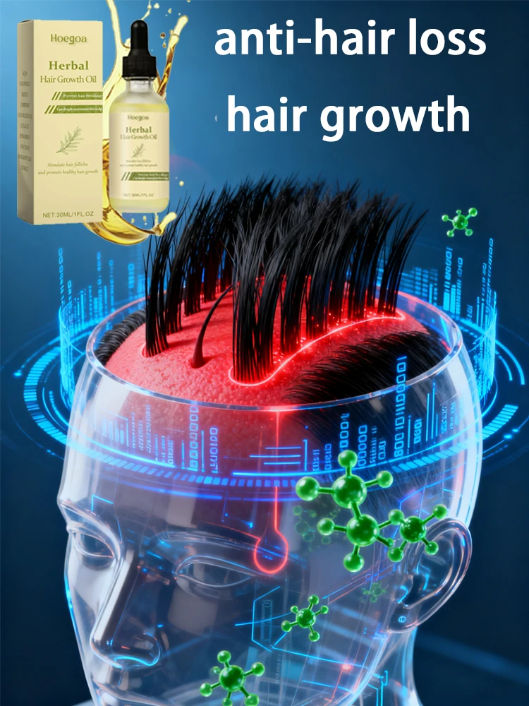 

Hair Growth Oil Strengthens Roots Improve Hair Loss Prevent Hair Loss Reduce Dandruff Scalp Treatment Essence