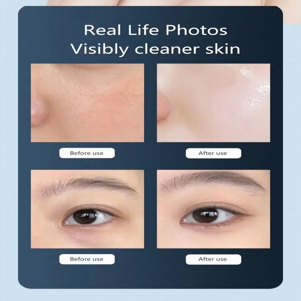 Hydra Skin Care Bubble Pen Maschine 14 IN 1 Sauerstoffstrahl Aqua Gesichtsbehandlung Tiefenreinigung Dermabrasion Gesichtsstraffung Schönheitsausrüstung