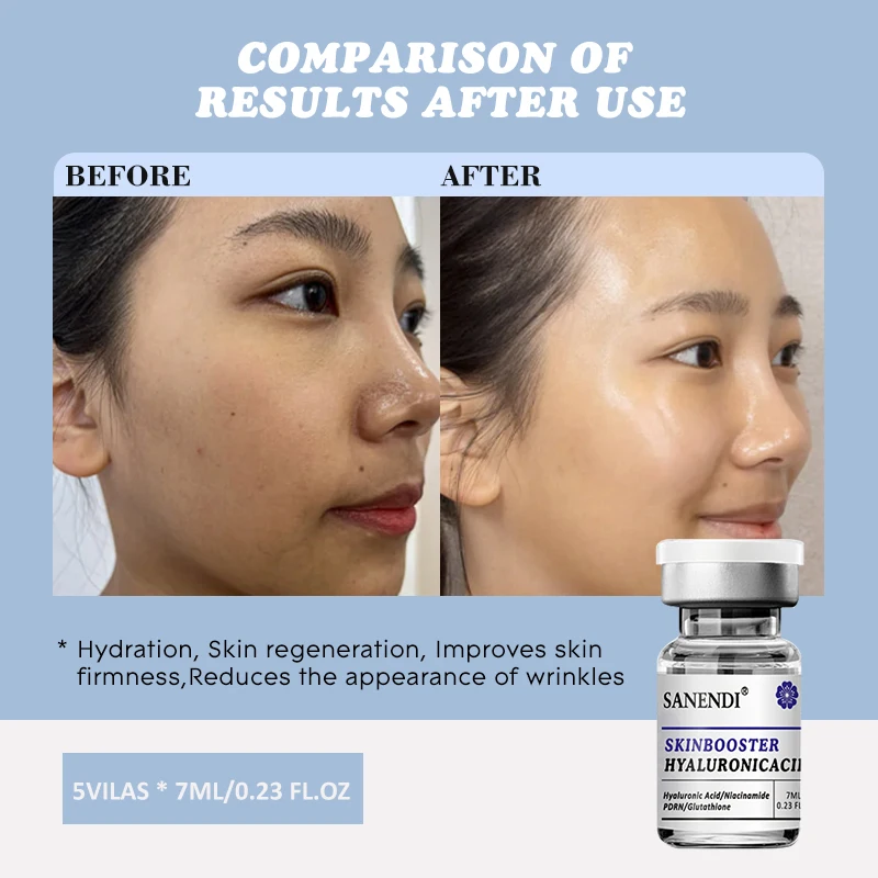 

Сыворотка Sanendi с гиалуроновой кислотой, PDRN, глутатионом и ретинолом для лица Dr.Pen: Глубокое увлажнение, повышение упругости, антивозрастной эффект, 7 мл * 5 флаконов