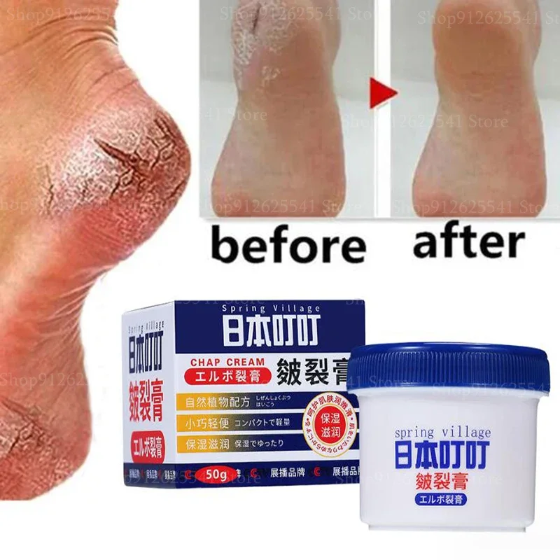 50g Anti-Drying Crack Foot Cream for Removing Dead Skin and Dry Heels Hand and Foot Protection Cream for Anti Freezing