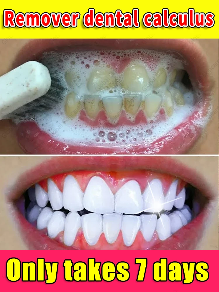 مزيلات الجير تزيل الجير ويزيل البقع