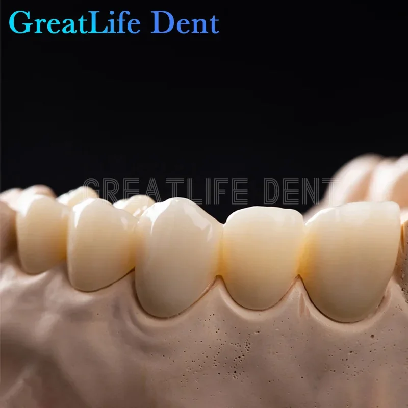 GreatLife Dent ST-C zbadać funkcjonalne 4D wielowarstwowe bloki cyrkonowe laboratorium dentystyczne Materia 98mm System 12-30mm CAD CAM 43%-57%