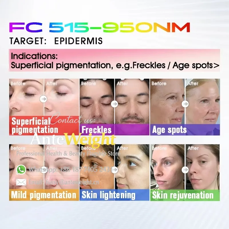Multi-Functional BBL Lasering 8 Filters Skin Tightening Face Lifting Hair Removal Anti Aging Broadband Light Machine