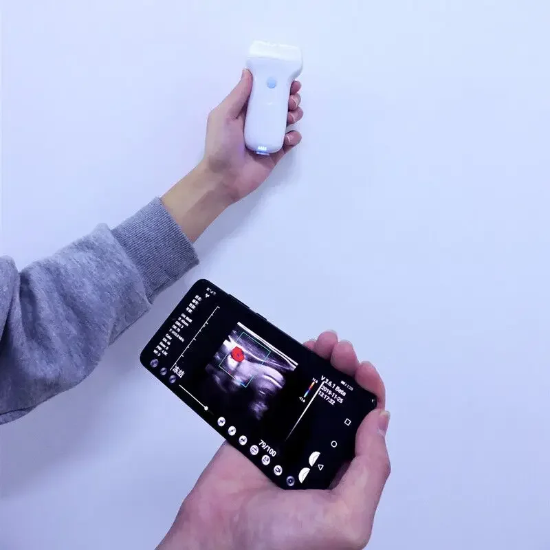 

2023 Best-selling Mini Wifi & USB Handheld Portable Wireless Ultrasound for Physiotherapy and Surgery C10UL