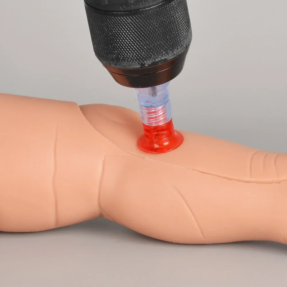Ultrassist Infant Tibia IO Trainer Model Pediatric Intraosseous Leg Tibia Injection & Infusion Practice for Medical Education