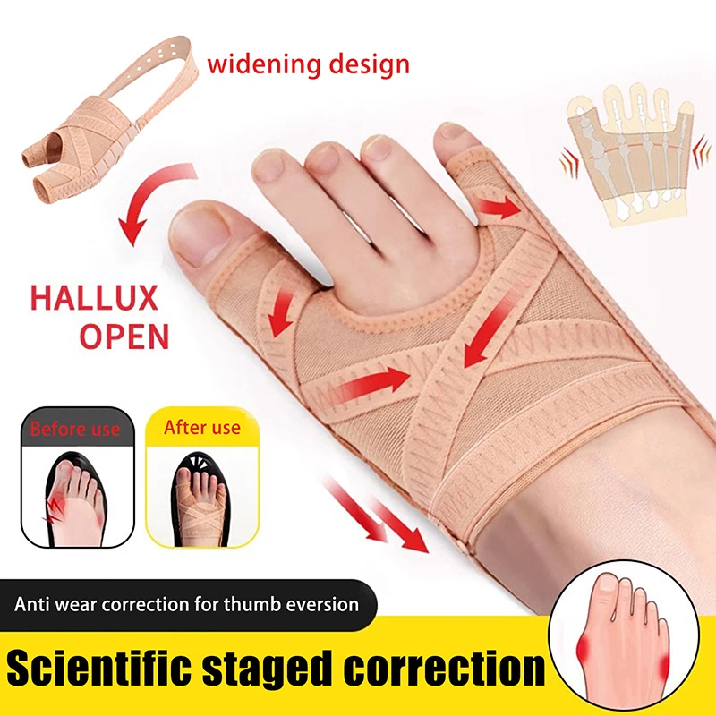Fabric Bunion Corrector Adjustable Hallux Valgus Sleeve Toe Separator Foot Care Tool
