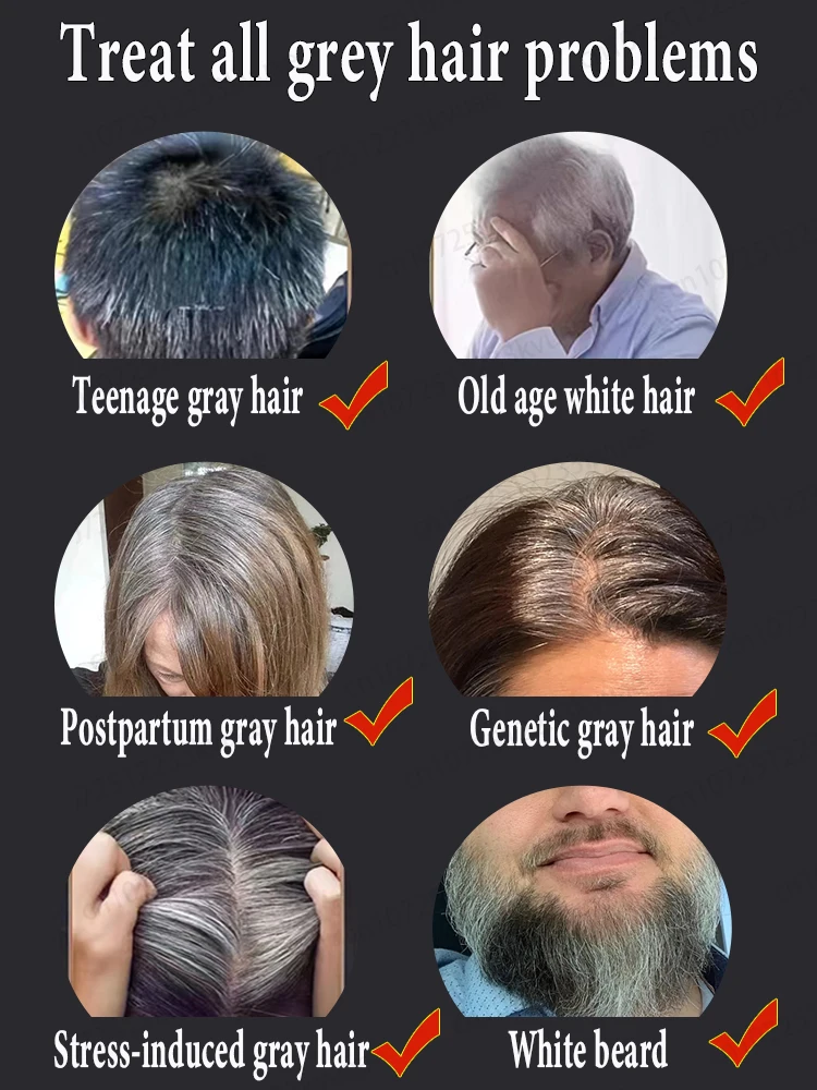 Ontdoe je van grijs haar en herstel je natuurlijke haarkleur: de beste producten voor grijs haar in 2025, 99% van de mensen zal uitstekende producten opnieuw kopen