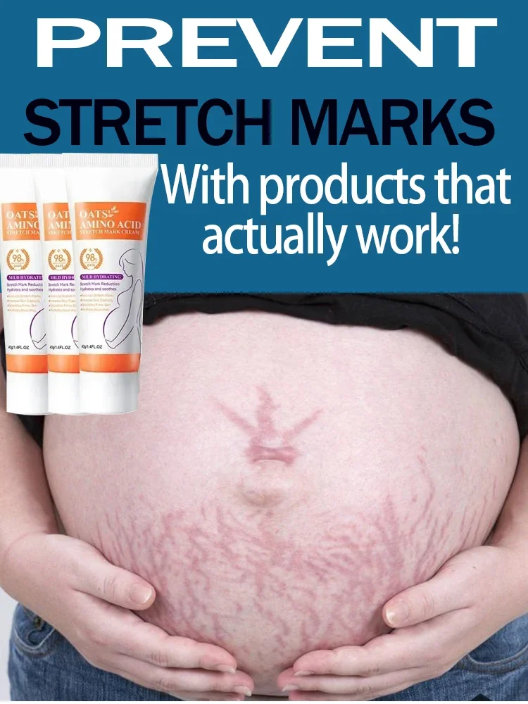 

Stretch Marks Permanent Removal Cream Eliminate Body Belly Stretch Marks Swelling Marks Remove Skin Cracks Repair Firming Care