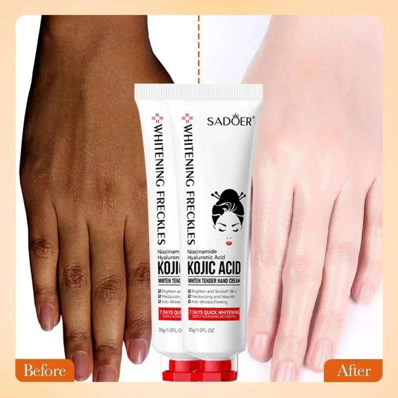 

Niacinamide Hyaluronic Acid Tender Whiten Hand Cream,Korean Handcream,Foot Moisturizer,Kojic Acid Hydrating Nourishing Lotion