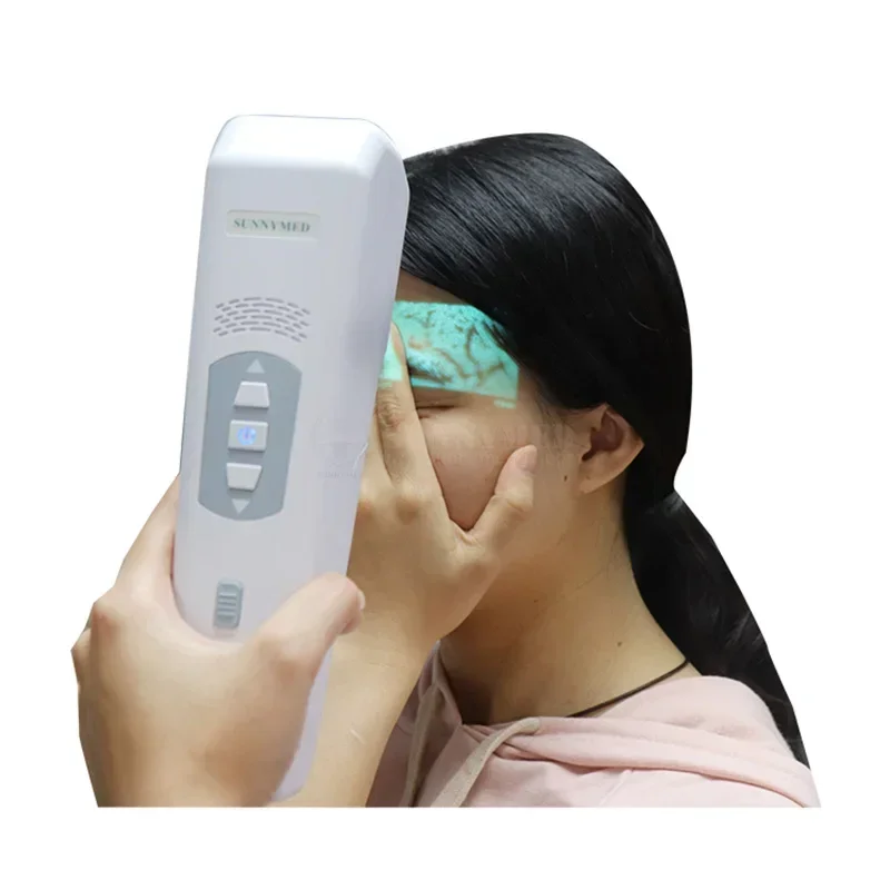 

2025/SY-G090T Infrared Portable Vein Finder for and venipuncture