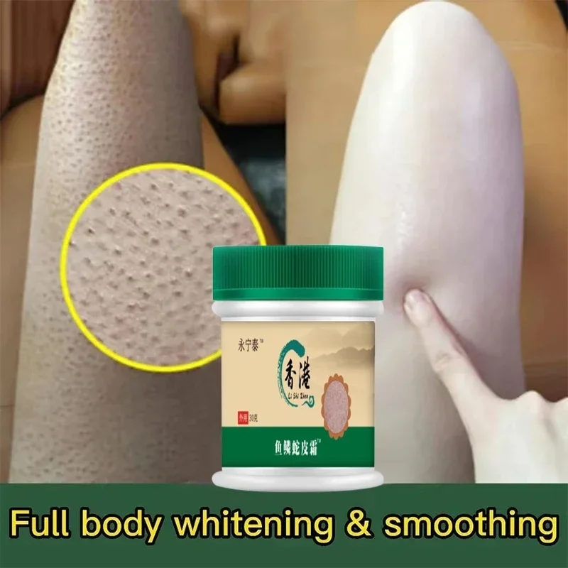 Tratamento de remoção de pele de frango creme corporal diluir e remover células da pele morta poros ponto maçante clareamento hidratante creme de cuidados com o corpo