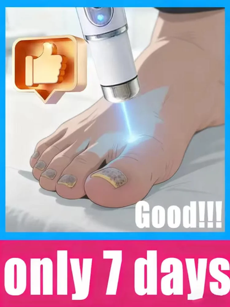 

Nail repair laser equipment, blue light, nail care tools.