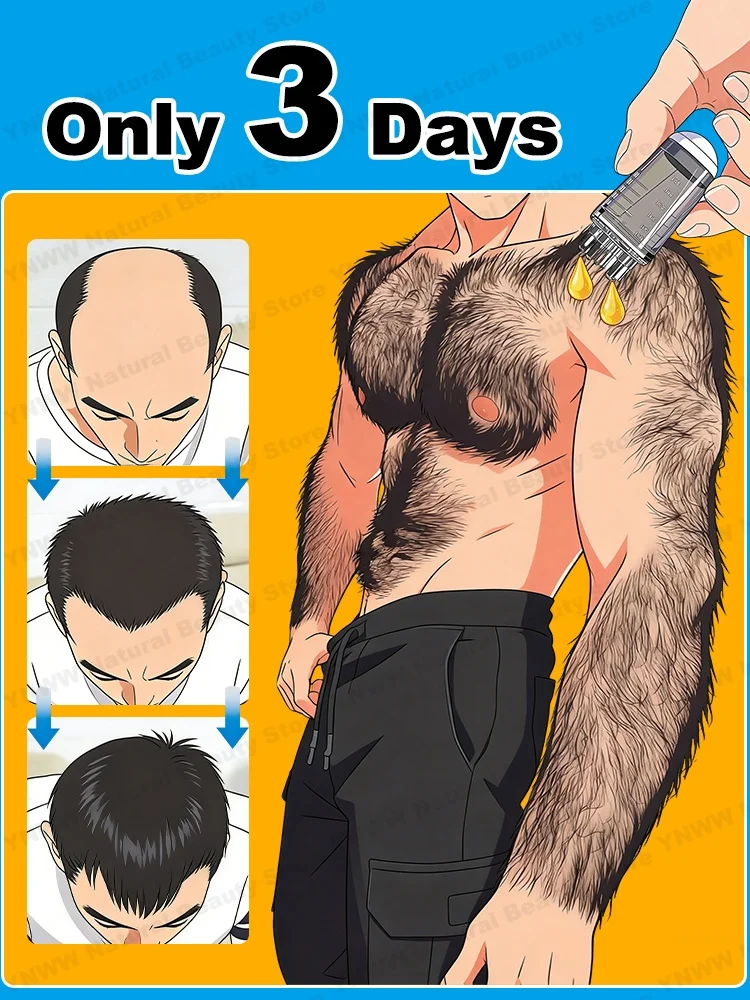 Very popular, best-selling during promotions, free shipping, helps people with hair loss.