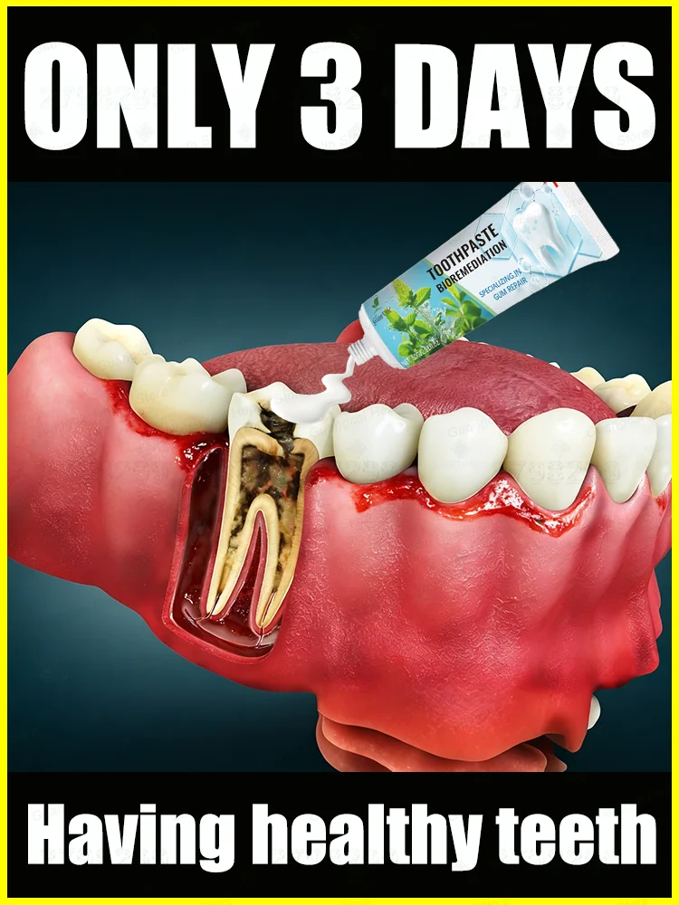 

Sᴄɪᴇɴᴛɪғɪᴄᴀʟʟʏ ʀᴇᴘᴀɪʀs ᴄᴀᴠɪᴛɪᴇs, ʀᴇᴍᴏᴠᴇs ᴛᴀʀᴛᴀʀ, ᴀɴᴅ ᴛɪɢʜᴛᴇɴs ᴛᴇᴇᴛʜ.