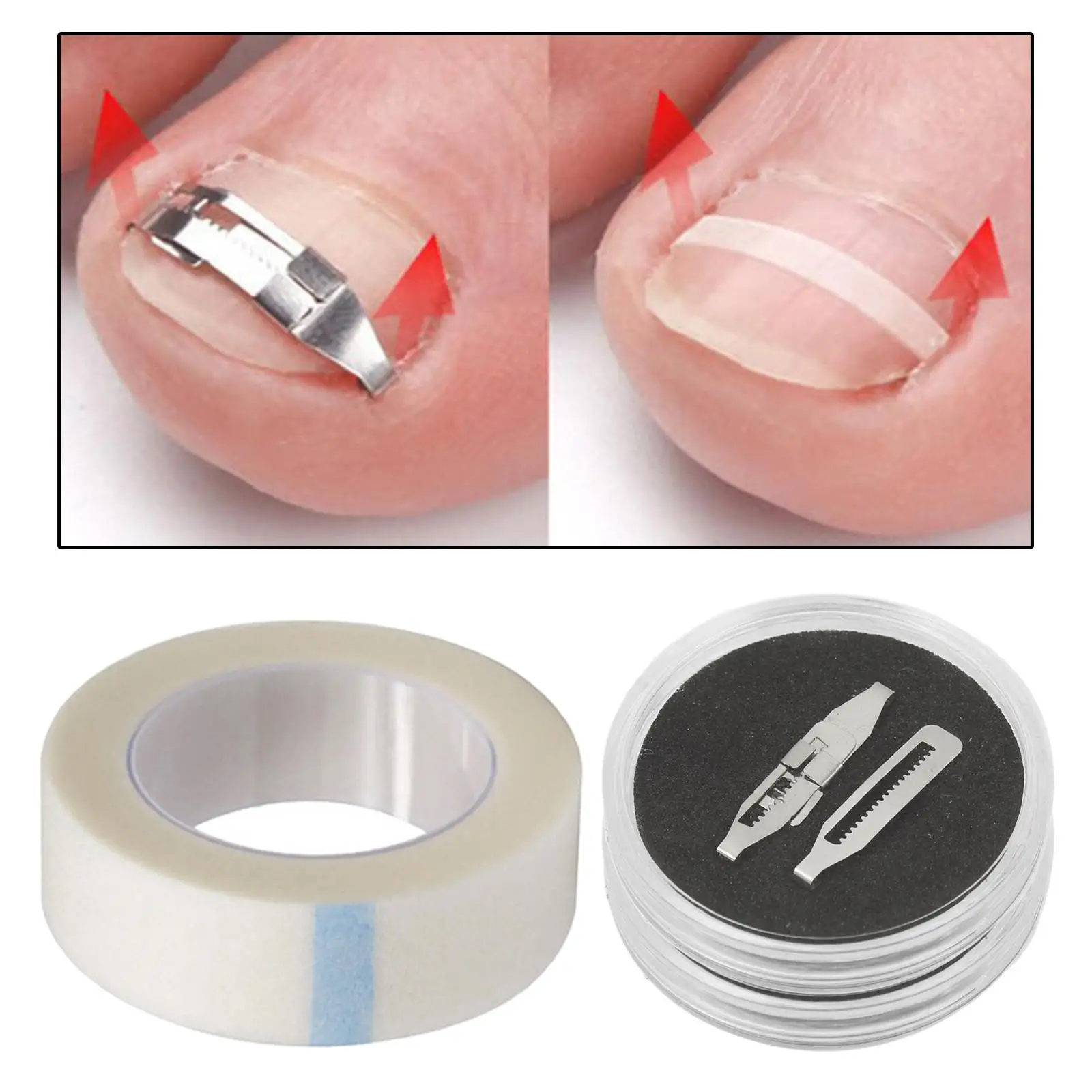 أدوات مصحح أظافر القدم الغارزة المهنية تضمين علاج أظافر القدم