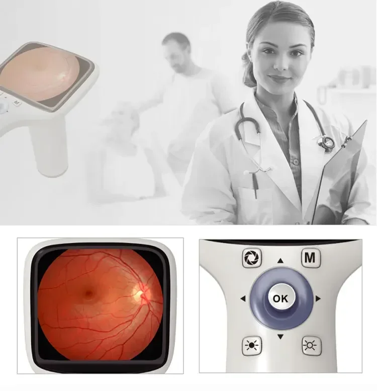 2022 Popular High Resolution 42 degree Portable Handheld Digital Fundus Retinal  FC-100