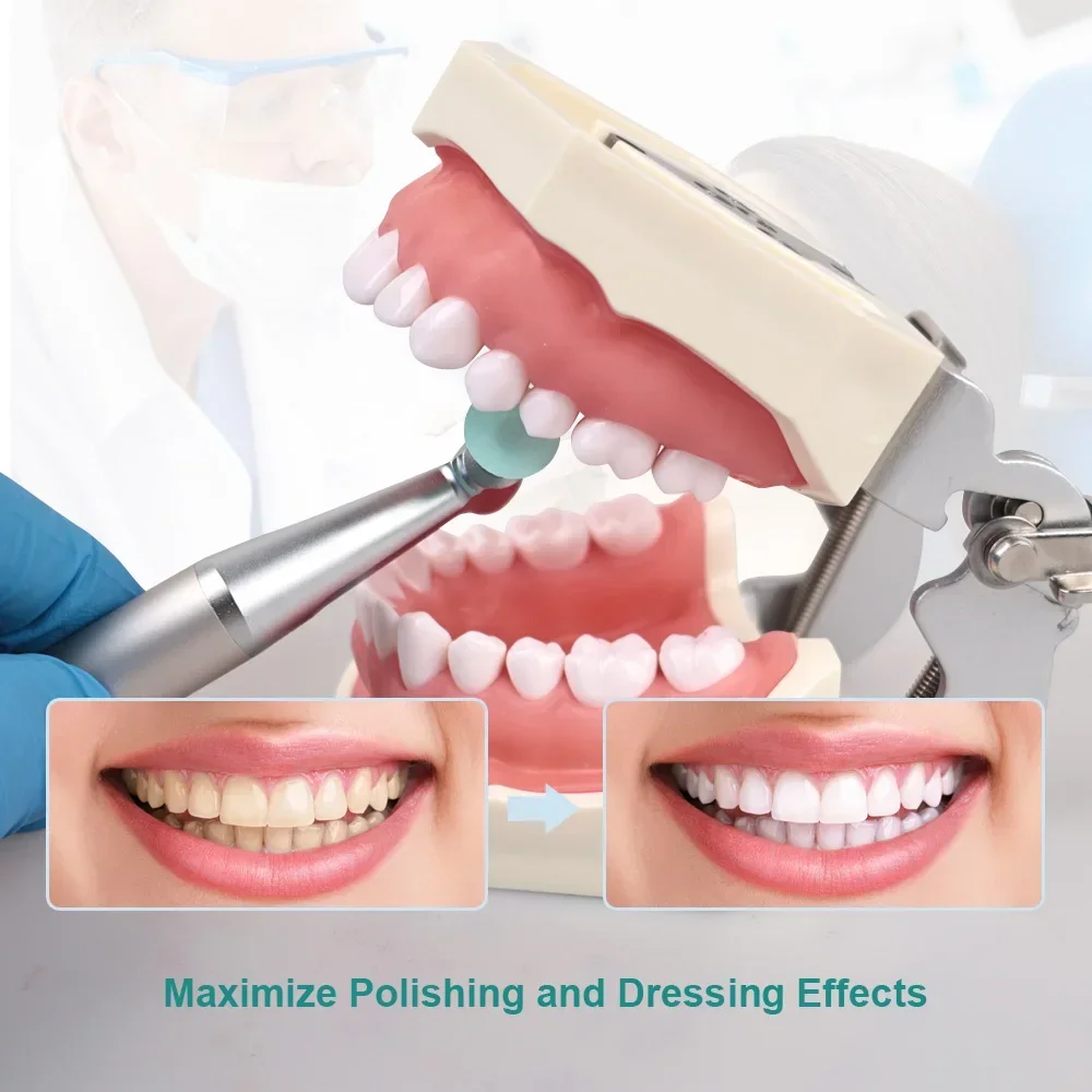 ELIJAH Dental Composite Resin Polishing Separating Polishing Mandrel Discs NO 1.620 for Low Speed Machine Polishing Dentistry view 5