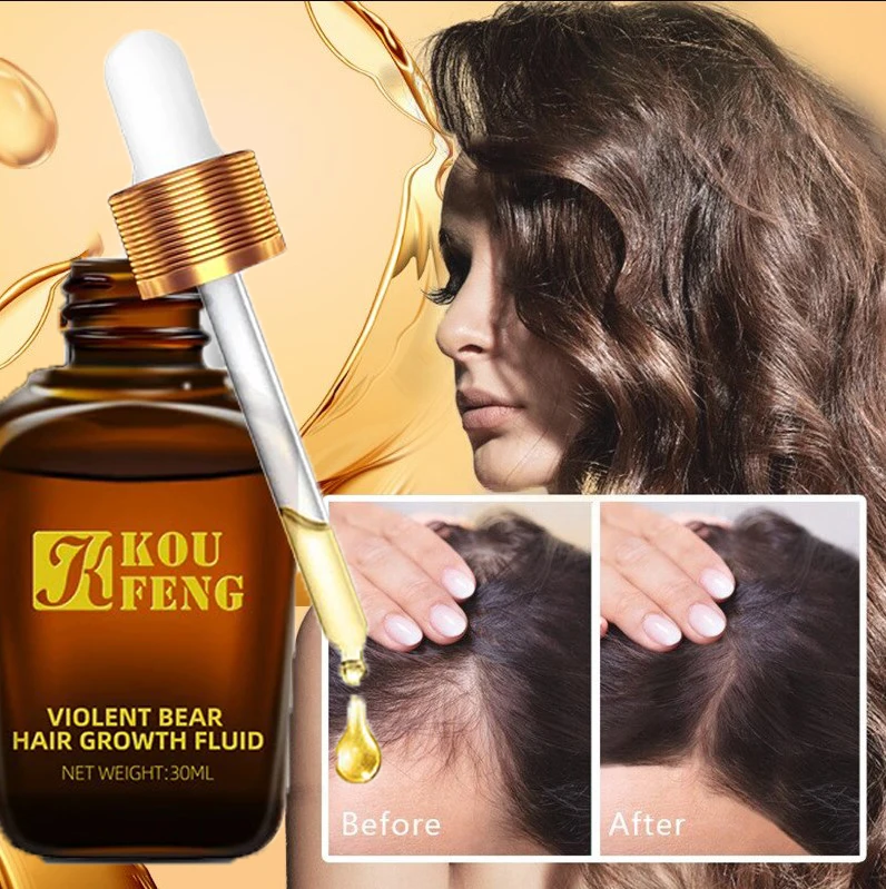 KouFeng Hair Growth Essential Oil Natural Anti Hair Loss Products Fast Grow Prevent Baldness Treatment Germinal Liquid Men Women