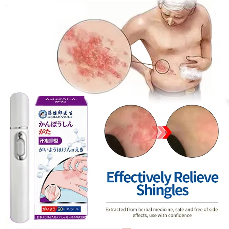 

Точный диагностический инструмент Shingles с ЖК-дисплеем Herpes Simplex Cure для мужчин и женщин Shingles Approval Genital Herpes