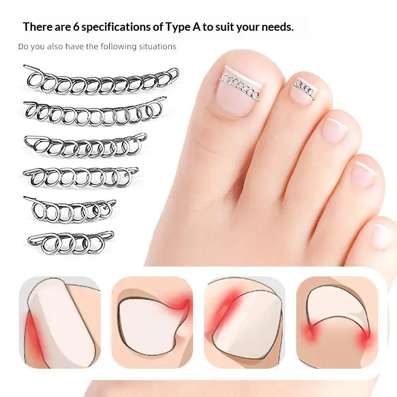 *12Pcs / Box Ingrown Toe Nail Corrector Spring Wire Fixer Pedicure Recover Straightening Clip Patch Toenails Orthotic Foot Care