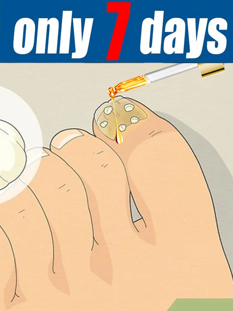 

UPgradeRejuvenator - Технология предотвращения грибка - Регулируемый контроль и датчик безопасности, 2026 унисекс.