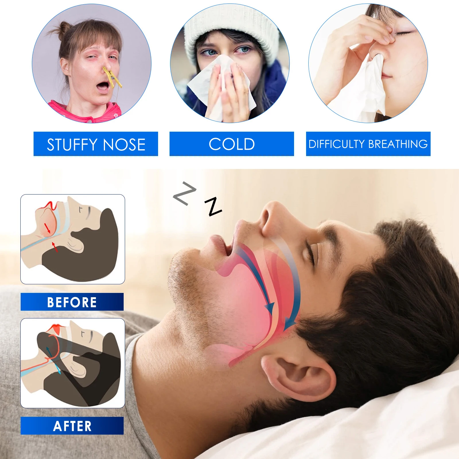 Dilatateur nasal anti-ronflement en silicone pour hommes et femmes, pince antarctique, aide à respirer facilement, améliore la rhinite au sommeil,