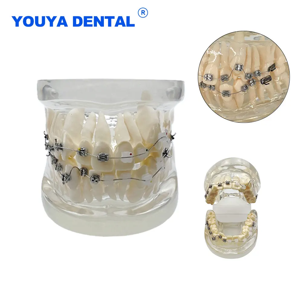 

Dental Transparent Teaching Model Orthodontic Teeth Model With Metal Wires and Bracket for Patient Communication Studying Demo