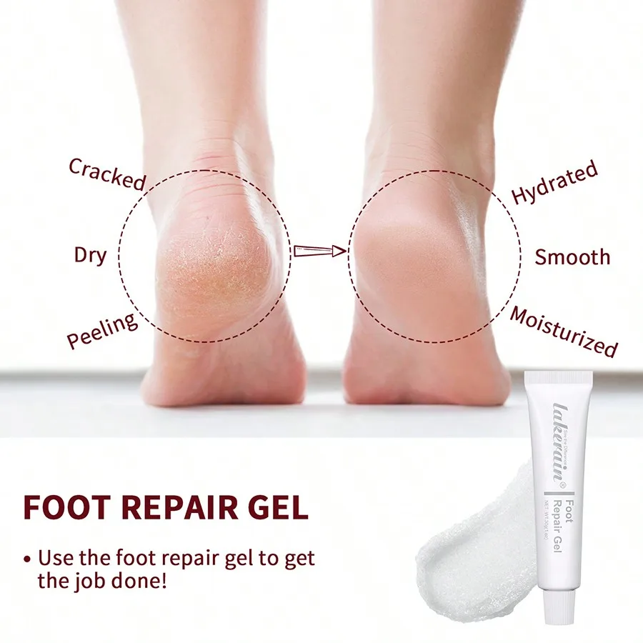 Repairing Foot Crack Cream Deep Moisturizing Treatment for Dry Cracked Skin and Exfoliation view 3