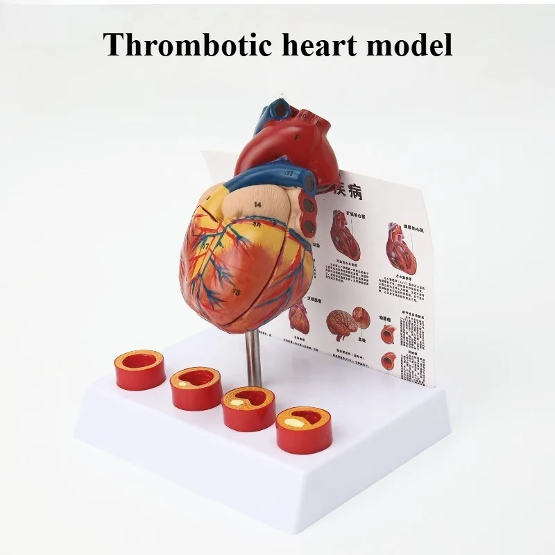 Heart Anatomy Thrombosis Model Natural Teaching Instrument Human Heart Anatomy Ultrasound Ultrasound Medical Model