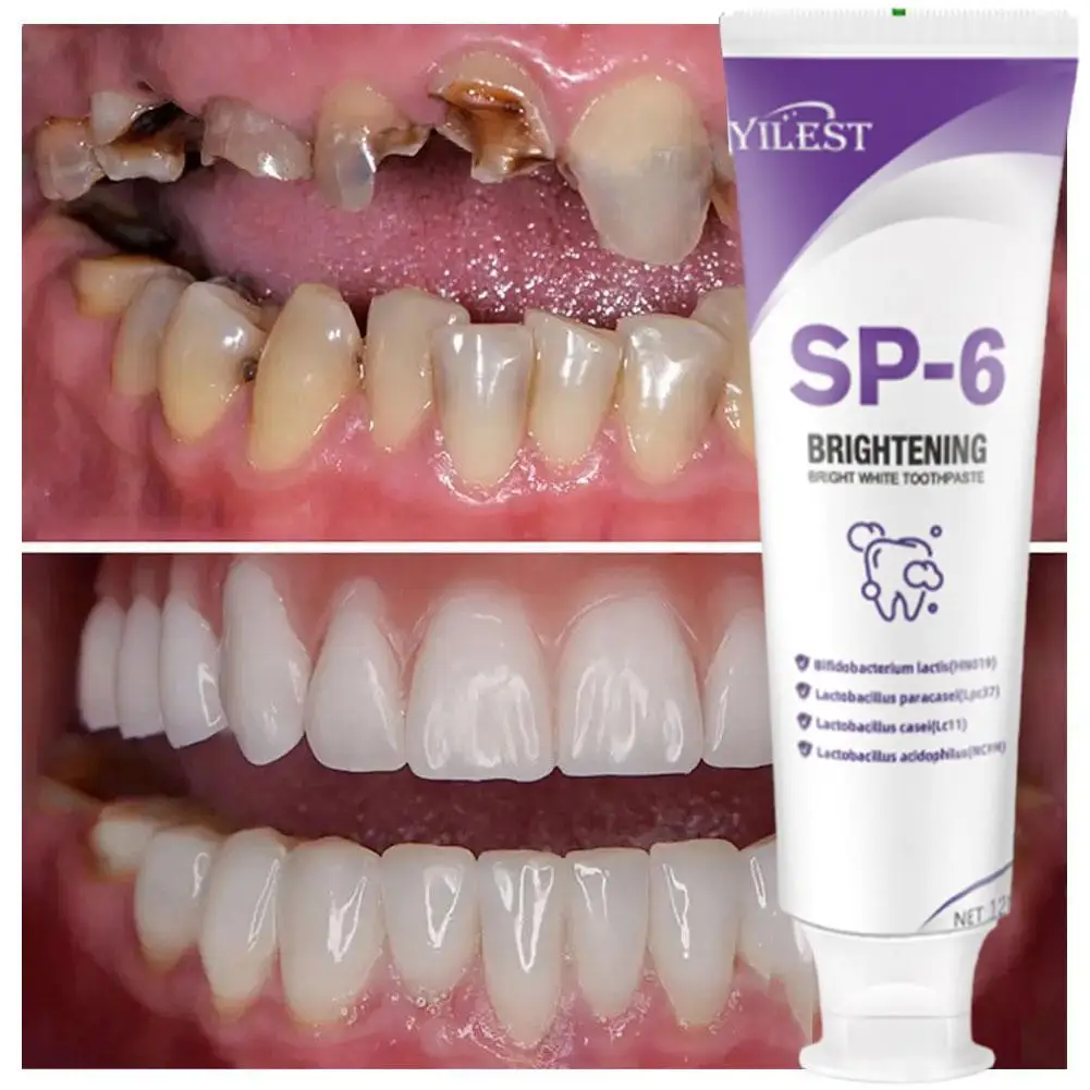 SP-6 Probiotische Tandpasta Whitening Tand Verwijderen Plaque Vlekken Tanden Whitener Mondhygiëne Schone Frisse Adem