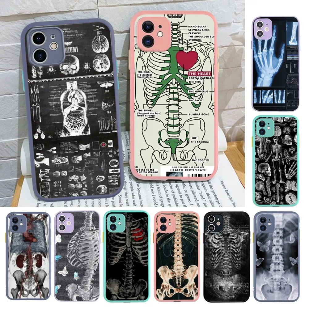 

Radiological Human Organs Skeleton Skull Phone Case For IPhone 14 X XR XS 7 8 Plus 11 12 13 Pro MAX 13mini Matte Shockproof Case