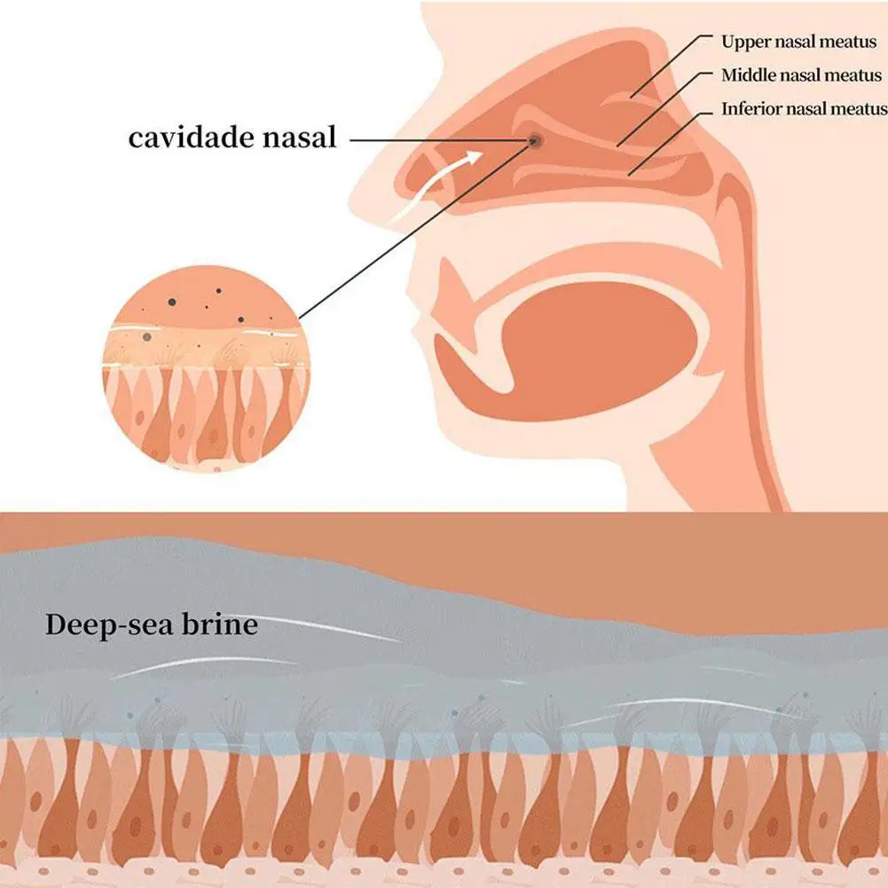 Lote de pulverizador Nasal de extracción de propóleo, tratamiento de Sinusitis crónica, fresco, Nasal, incomodidad de picazón, hierba de gota T0N3