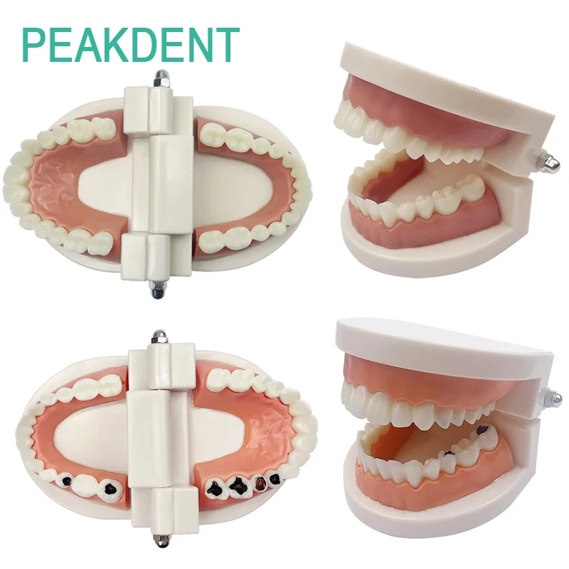 

1PC Standard Dental Adult Teeth Model Teaching Study Typodont Demonstration White Dentist Children Teeth Brushing Training Model