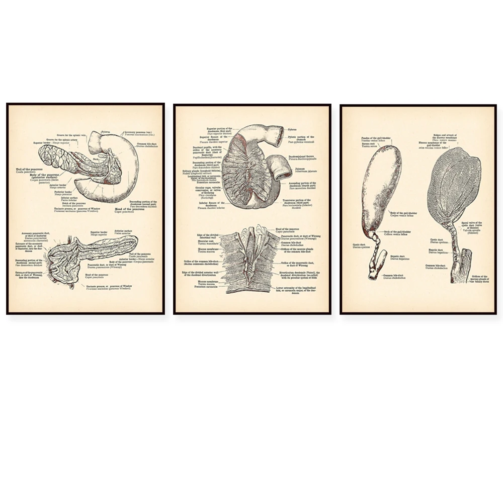（Unframe 3PCS）-Anatomical Internal Organs Vintage Poster Pancreas Gall Bladder Stomach Intestines Antique Decor Gastroenterol