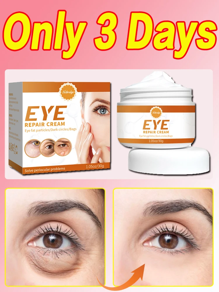 

Eye Bags Cream Removal Eyes Wrinkle