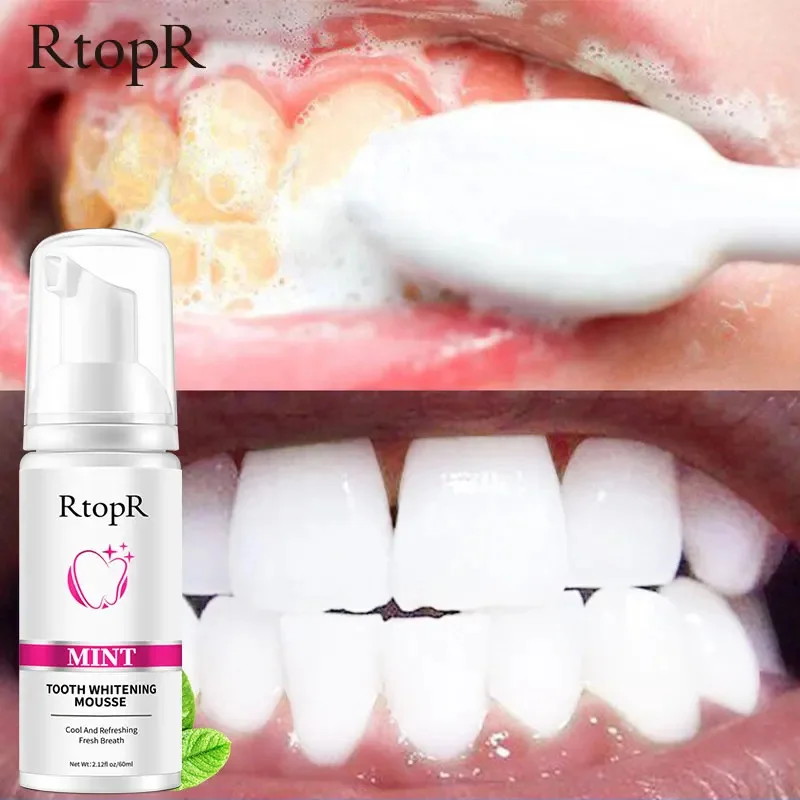 RtopR Teeth Whitening Toothpaste Remove Plaque Stains Serum Dental Bleaching Tools Oral Hygiene Cleaning Fresh Breath Tooth Care