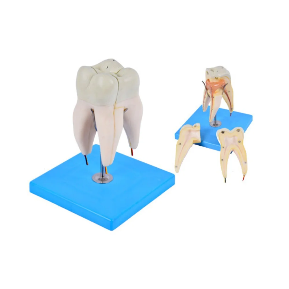 

Molars have three root models