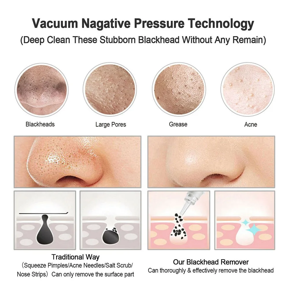 3 Suction Mode Electric Blackhead Remover Face Cleansing Dead Skin Removal Vacuum Pore Cleaner Blemish Remove Beauty Machine