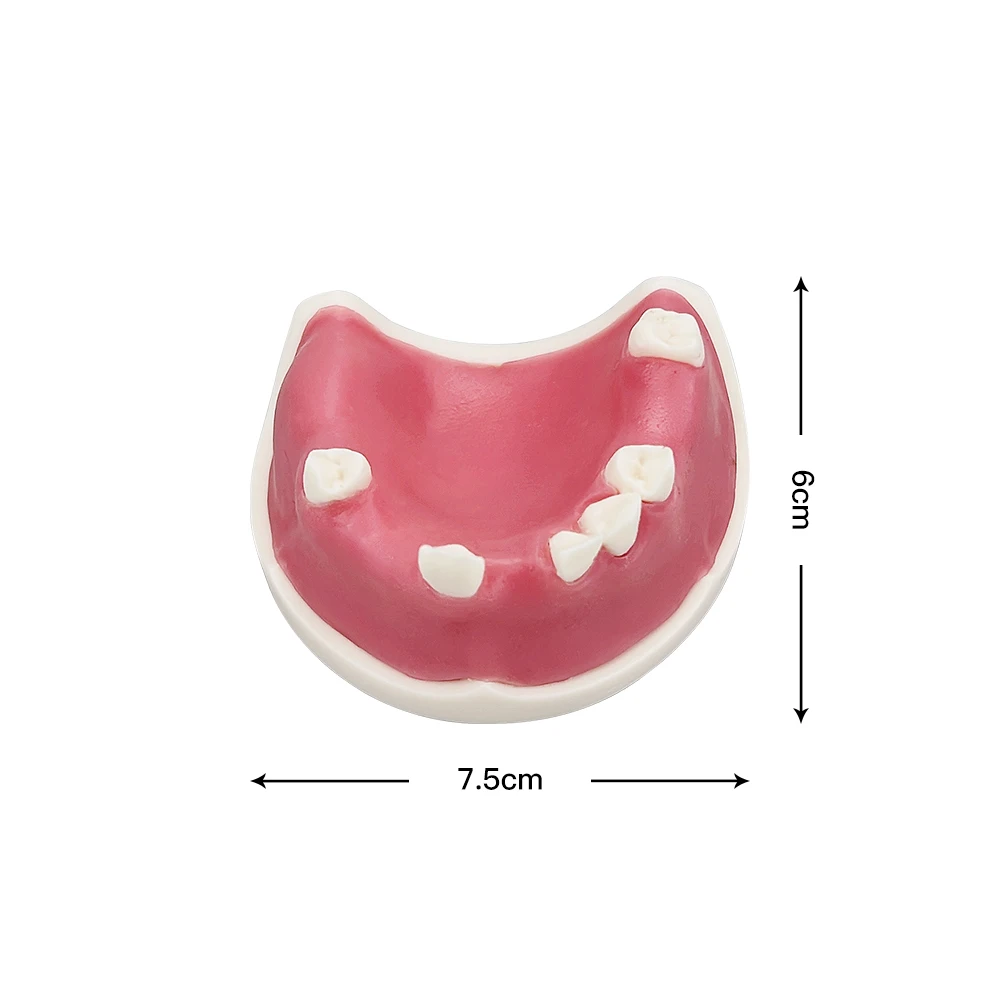 Dental Implant Training Model Soft Gum Teeth Practice Typodont With Missing Teeth Dentistry Studying Teaching Demonstration Tool