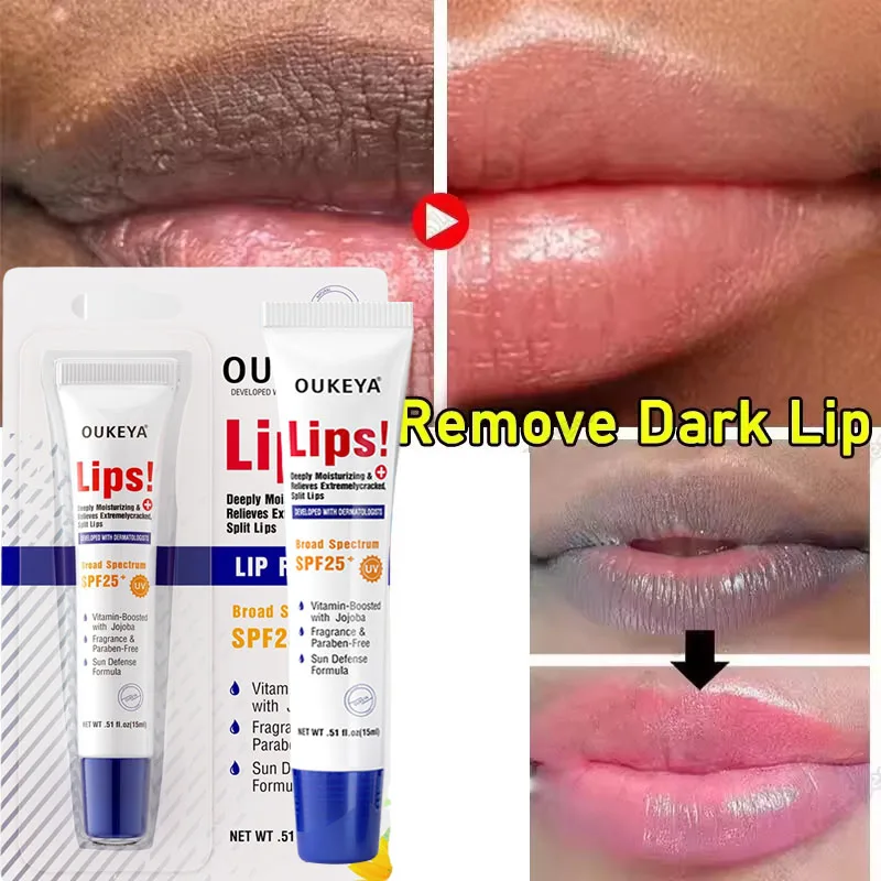 rapido-clareamento-rosa-boca-labios-soro-branqueamento-permanente-remover-fumaca-escura-labios-balsamo-labial-hidratar-brilho-batom-mascara-labial