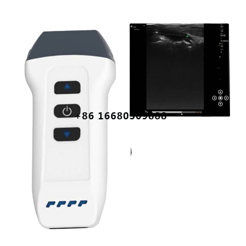 

"The Future of Medicine at Your Fingertips: Handheld Ultrasound Scanners in Point-of-Care Settings" DW-L2