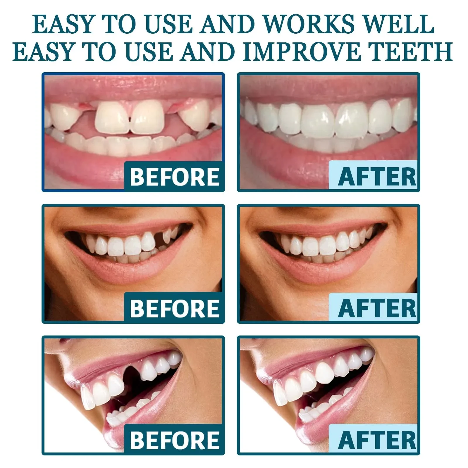 Adjustable Buckle Dentures Decorate Teeth Fill Gaps Correct Teeth Easy To Use. Suitable For Both Men And Women. Sentures Kit