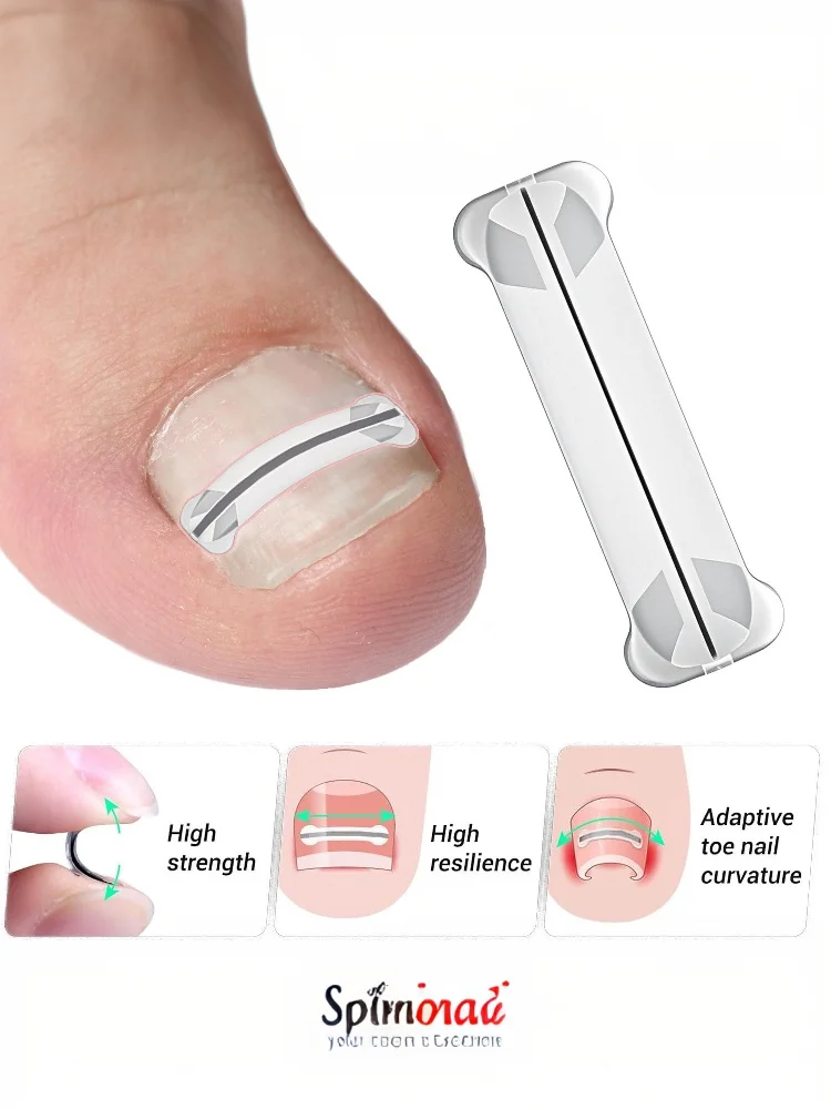 1Pcs 13-20mm Nail Correction Stickers Ingrown Toenail Corrector Patches Paronychia Treatment Recover Corrector Pedicure Tools