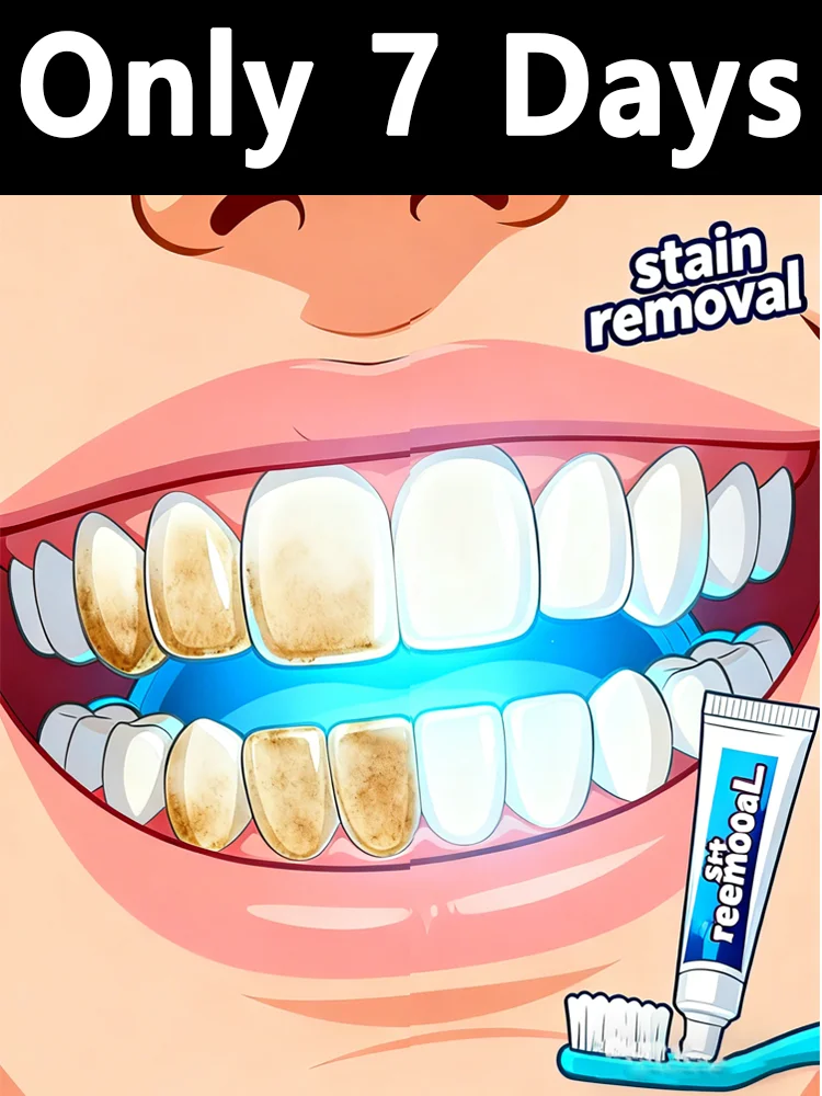 

Профессиональная отбеливающая зубная паста, профилактика полости и восстановление эмали