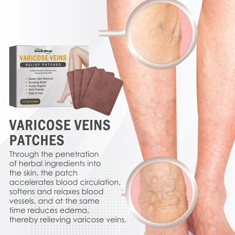 Varicose Veins Vasculitis Patch Vascular Veins Remover Spider Legs Treatment Chinese Medical Plaster Angiitis Stickers Skin Care